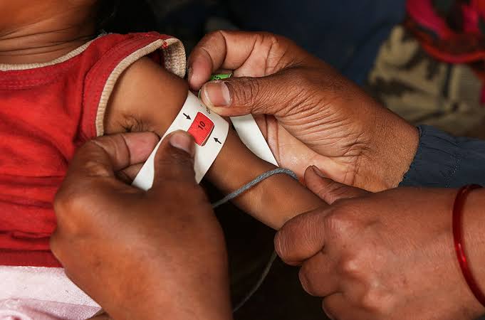 Child malnutrition screening using anthropometric equipment at an Anganwadi centre